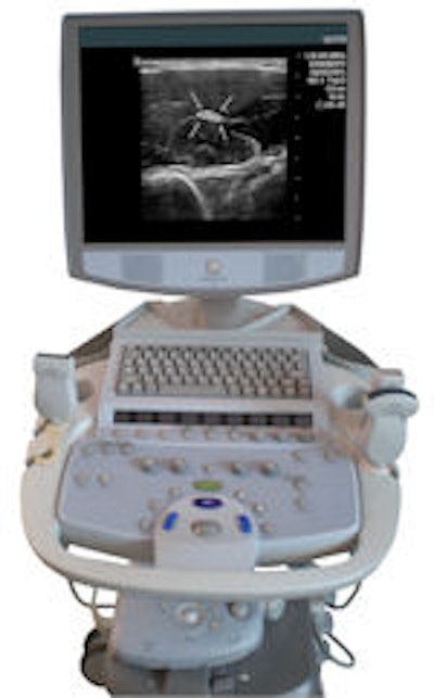 Zonare debuts new ultrasound system | AuntMinnie